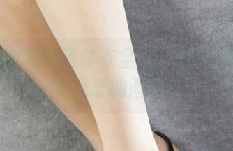 First Image