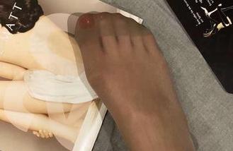 First Image