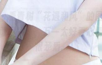 First Image